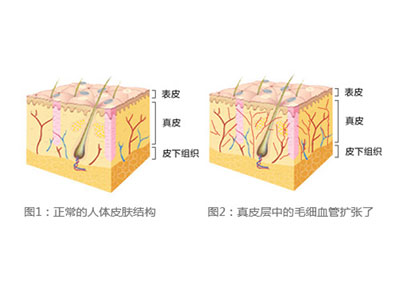 ȥѪ˿Ʒ980MyBoxؼϮ