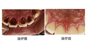 ��ǻ���������Ա�ͼ