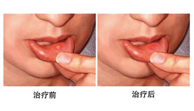 ��ǻ���������Ա�ͼ