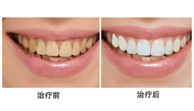 ��ǻ���������Ա�ͼ